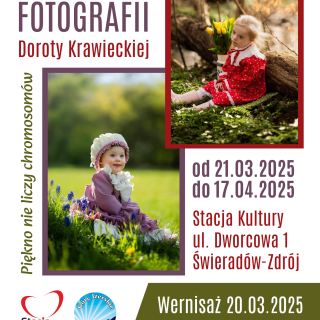 WYSTAWA FOTOGRAFII DOROTY KRAWIECKIEJ PT. &quot;PIĘKNO NIE LICZY CHROMOSOMÓW&quot;